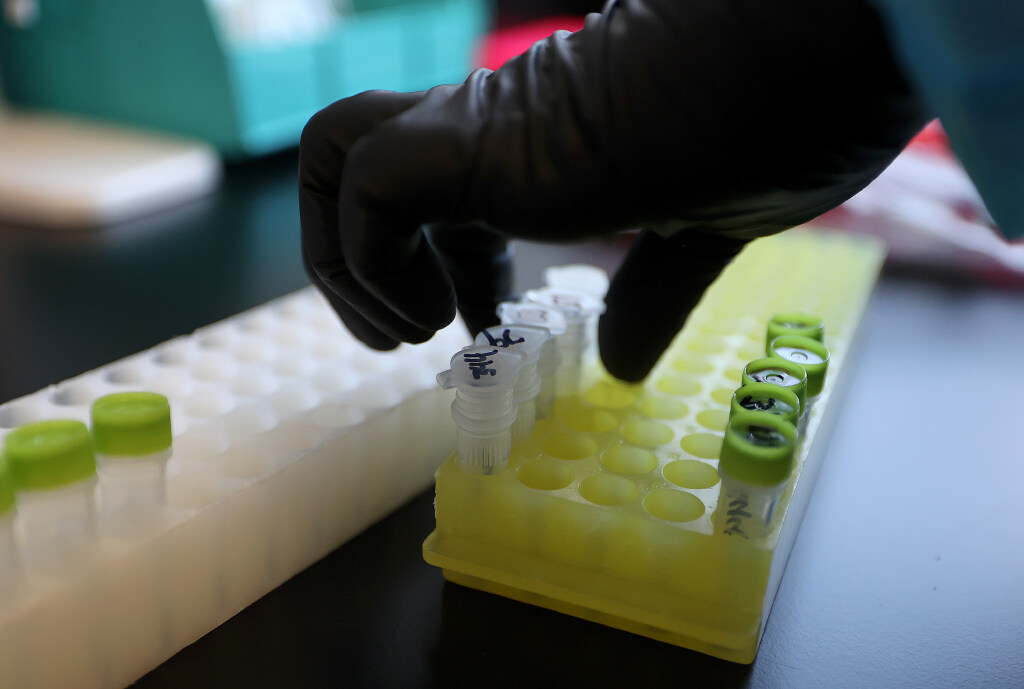 Monkeypox affecting Latino and Pacific Islander Utahns disproportionately