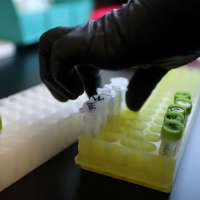 Monkeypox affecting Latino and Pacific Islander Utahns disproportionately