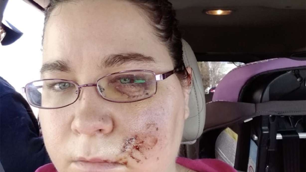 Brandy Jo Furniss was seriously injured when a rock from a passing truck went through the windshield of her car in 2019.