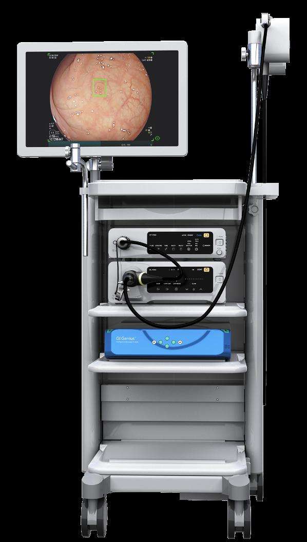 A depiction of a GI Genius unit in use. On Wednesday, Intermountain Healthcare announced the placement of these AI devices in four of its rural Utah hospitals to help doctors identify colon cancers earlier.