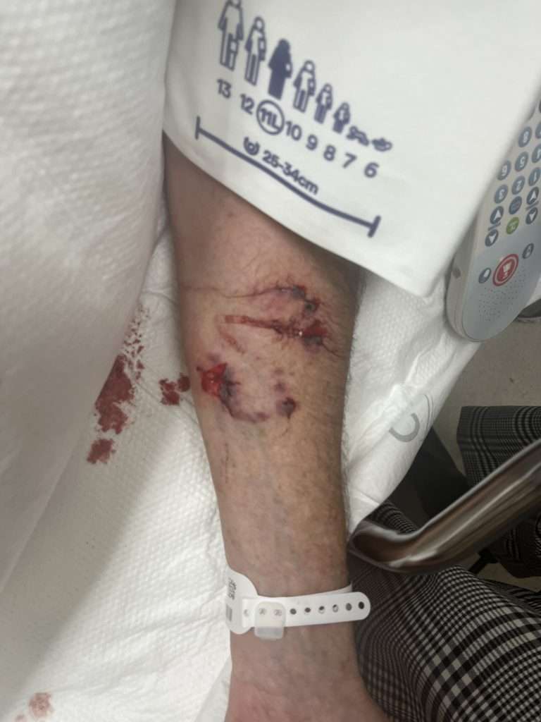 The family of a Millcreek man is desperately searching for a pit bull and its owner after the dog attacked him on Friday.