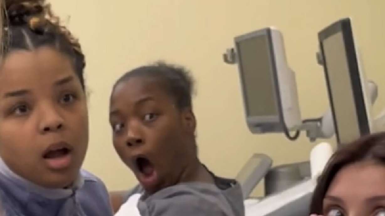 Ultrasound school students react with shock to their classmate's sonogram during a class lab in this screenshot from a video posted on Twitter.