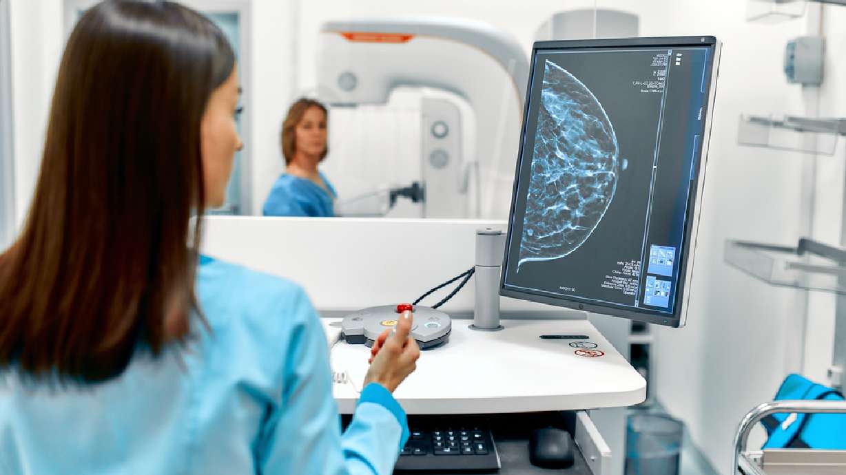 Why your next clinical breast exam should include a 3D mammogram