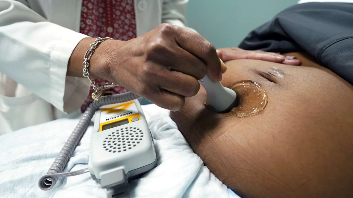 A hand-held Doppler probe is used to measure the heartbeat of the fetus Dec. 17, 2021, in Jackson, Miss. Statistics say the maternal death rate has skyrocketed for Indigenous women in Utah.