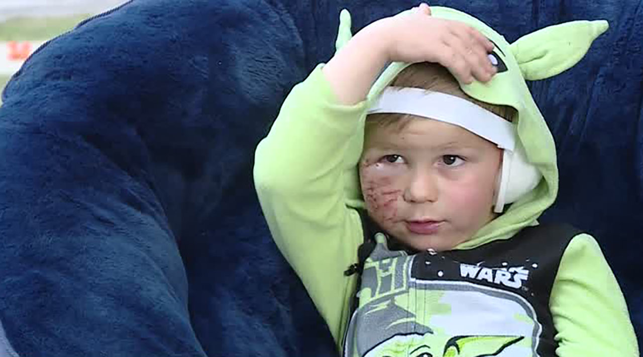 Mason Mihlberger, 5, of Sandy, talks to KSL on Thursday. He survived a dog mauling that sent him to the hospital Wednesday.