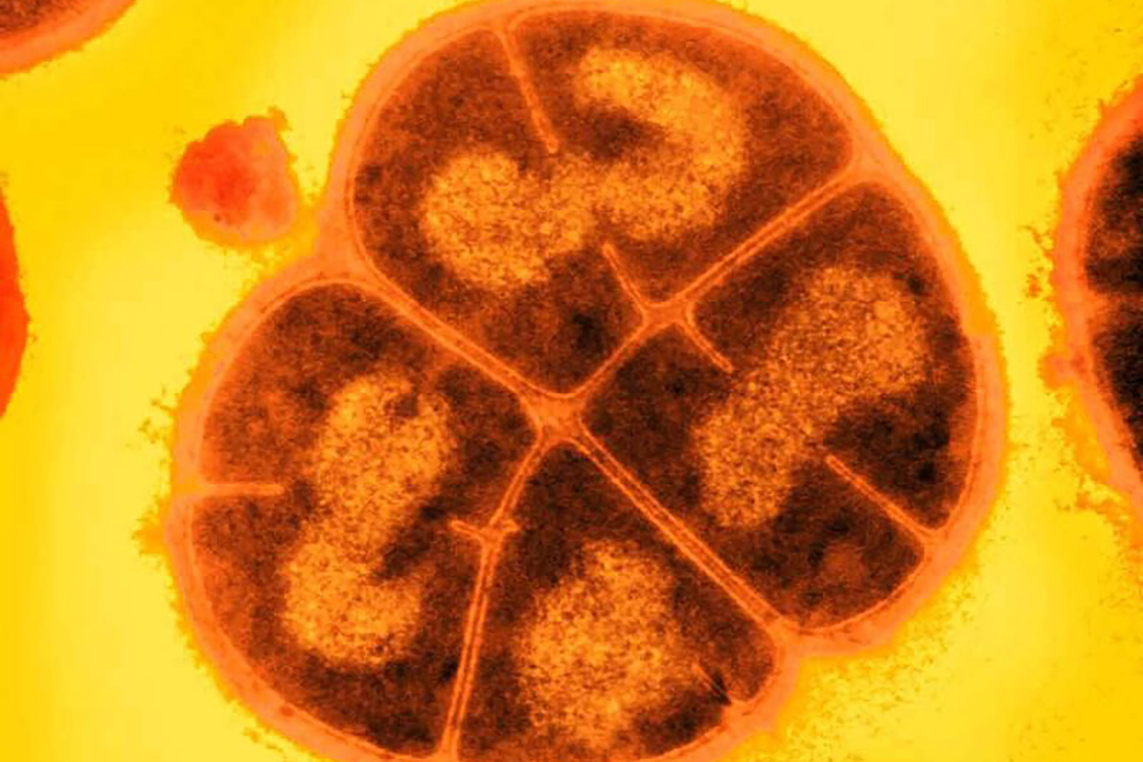 Deinococcus radiodurans, also called "Conan the Bacterium," is well suited to the harsh environment of Mars.