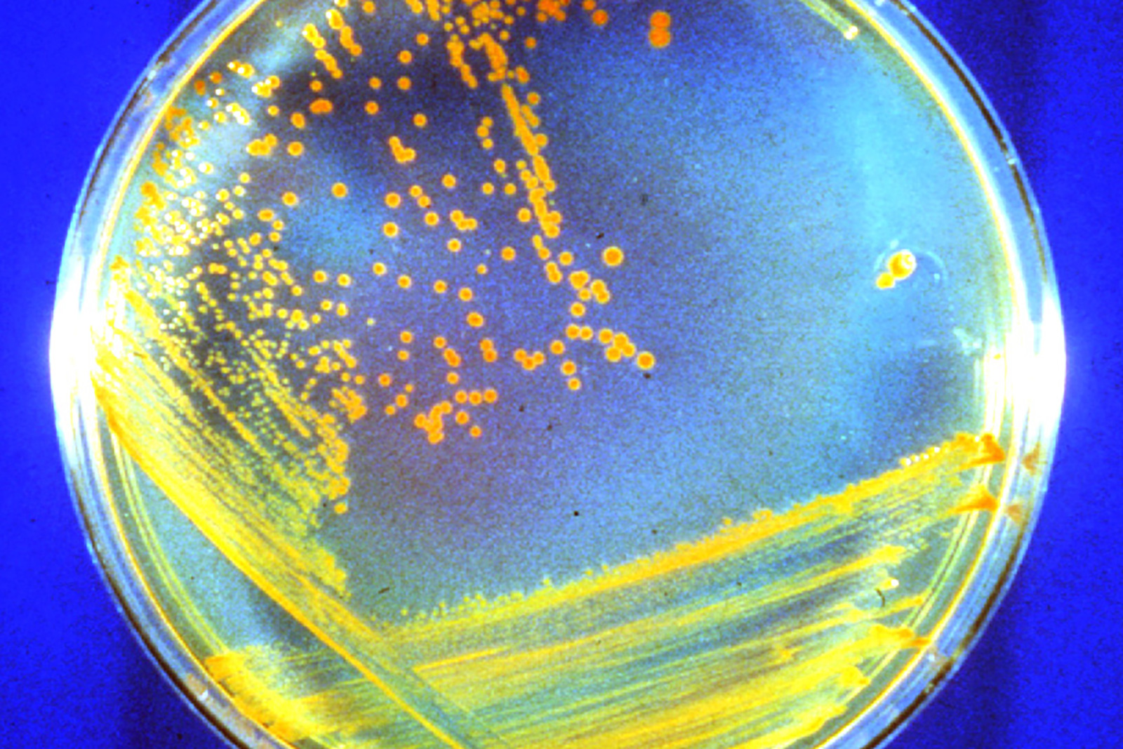 This is what "Conan the Bacterium" looks like growing on a nutrient agar plate in this undated photo.