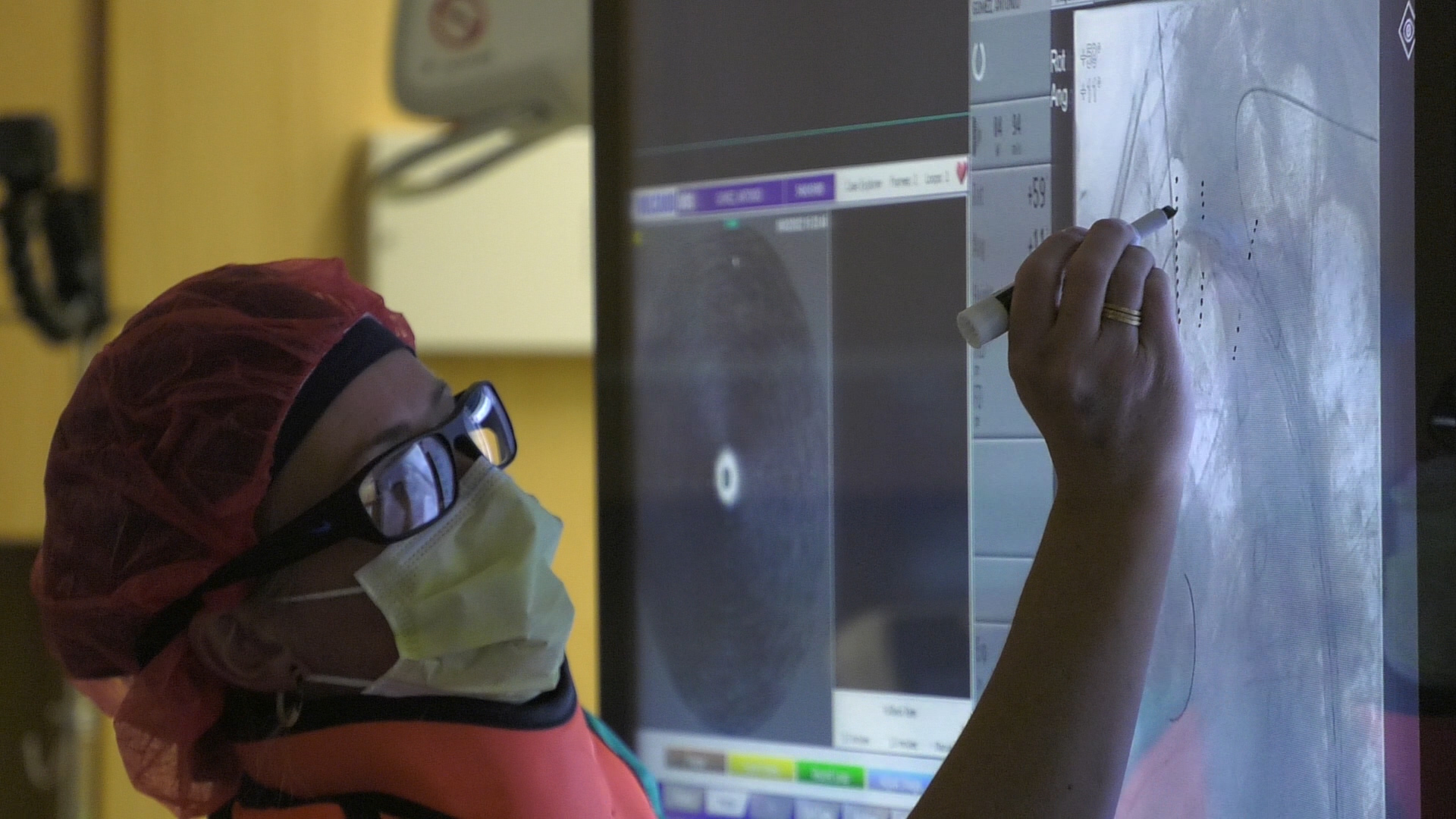 A medical professional in the operating room during a new aortic procedure.