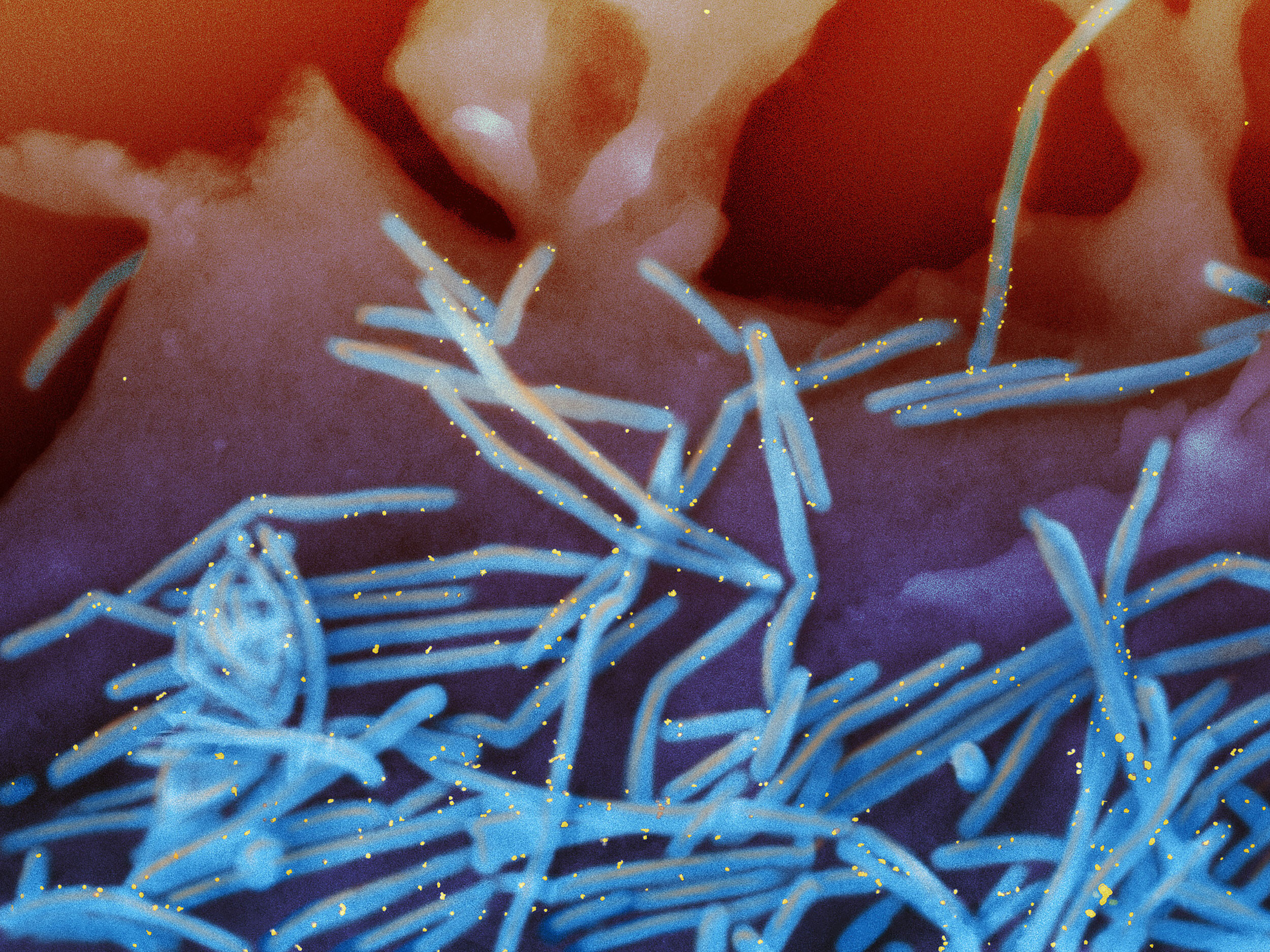 Scanning electron micrograph of human respiratory syncytial virus virions (colorized blue) that are labeled with anti-RSV F protein/gold antibodies (colorized yellow) shedding from the surface of human lung epithelial A549 cells is pictured here.