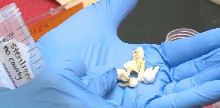 Researchers at the University of Utah say a person's teeth can help to identify where they have lived.