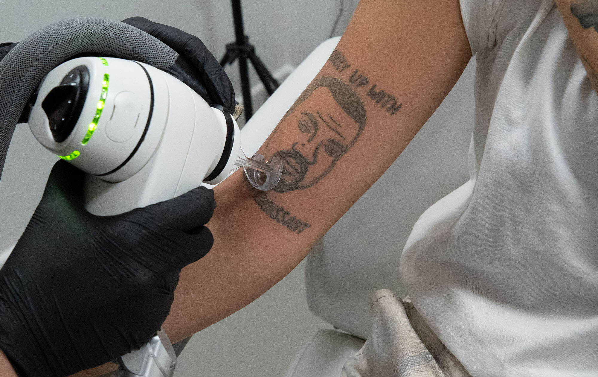 London-based tattoo removal studio NAAMA is offering free tattoo removal of Kanye West tattoos amid the musician's ongoing antisemitic comments.