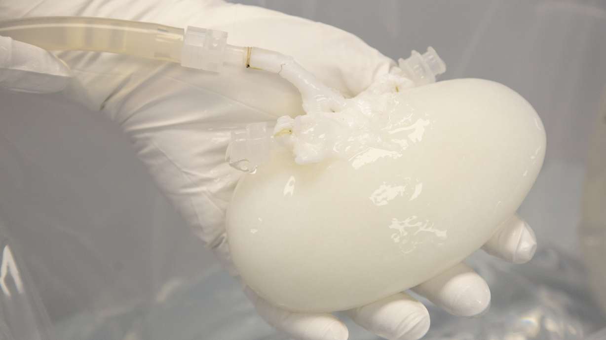 A pig kidney that has been "decelled" is held by a technician on Dec. 8, 2022, in Eden Prairie, Minn. It is gradually being transformed to look and act like a human one.