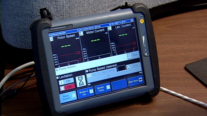 25th Anniversary of Historic Implant of Artificial Heart