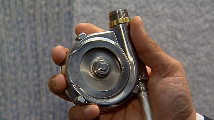 25th Anniversary of Historic Implant of Artificial Heart