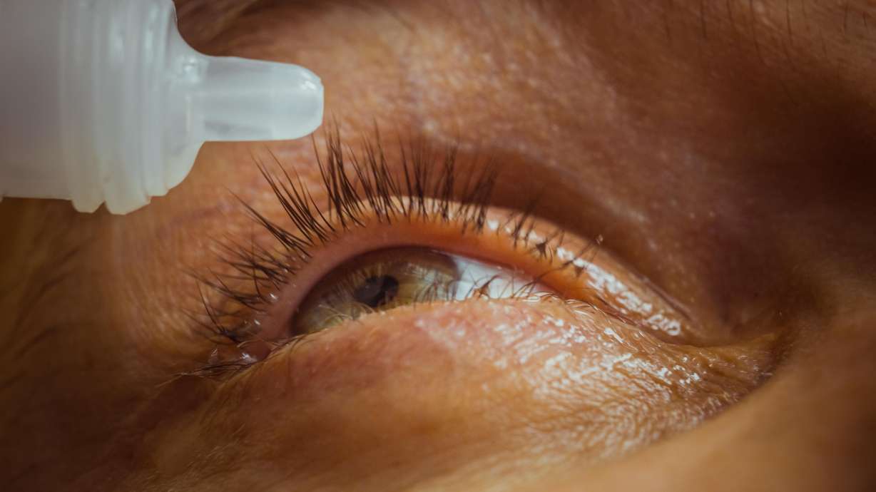 The CDC is advising people to stop using over-the-counter eye drops that have been linked to an outbreak of drug-resistant infections.