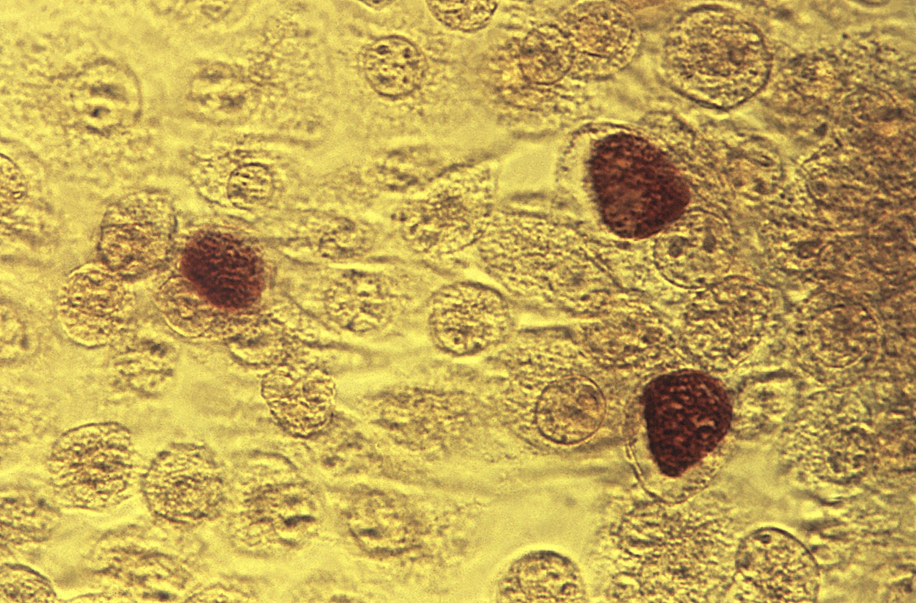 This 1975 file microscope image made available by the Centers for Disease Control and Prevention shows chlamydia trachomatis bacteria magnified 200 times. The number of babies born with congenital syphilis rose 900% over the course of five years in Mississippi.