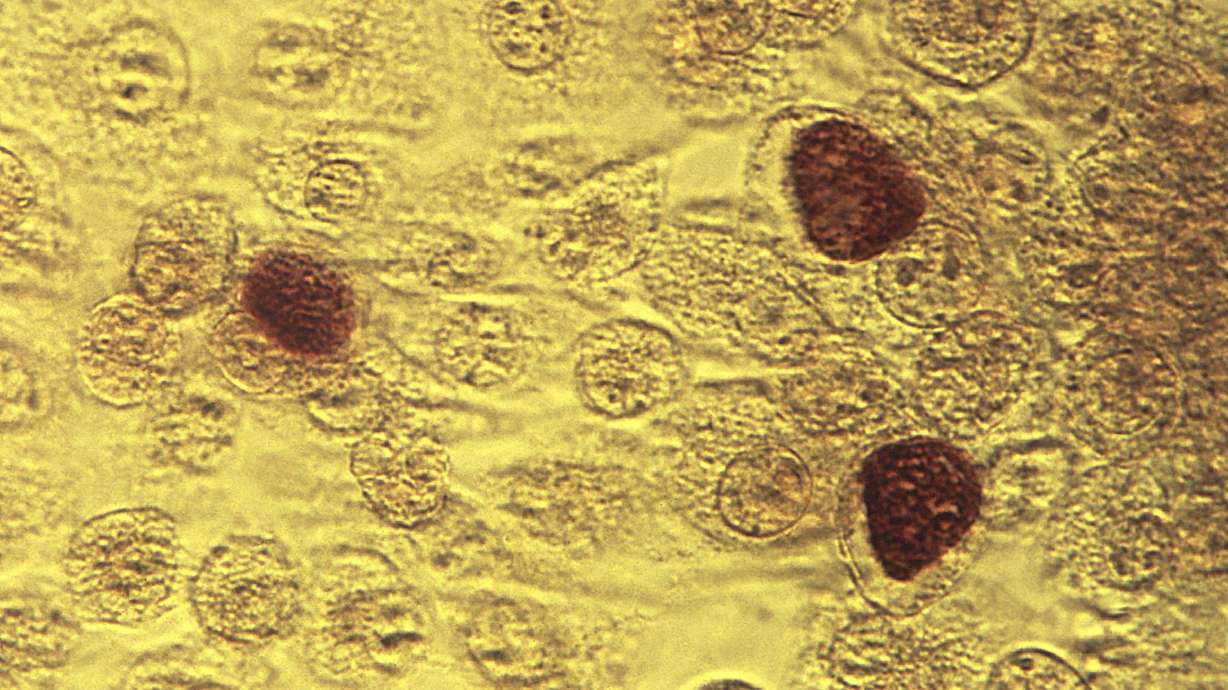 This 1975 file microscope image made available by the Centers for Disease Control and Prevention shows chlamydia trachomatis bacteria magnified 200 times. The number of babies born with congenital syphilis rose 900% over the course of five years in Mississippi.