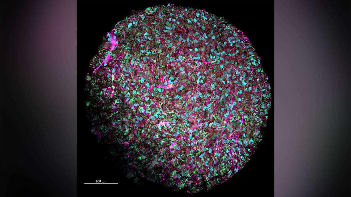 This magnified image shows a brain organoid produced in Hartung's lab. The most impactful contributions of organoid intelligence might manifest in human medicine, the researchers said.