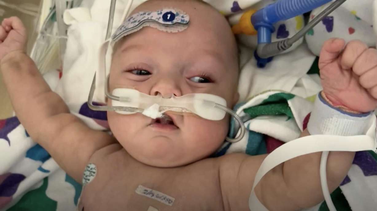 Isaac Shakespeare survives his rare condition and is waiting for a kidney transplant.