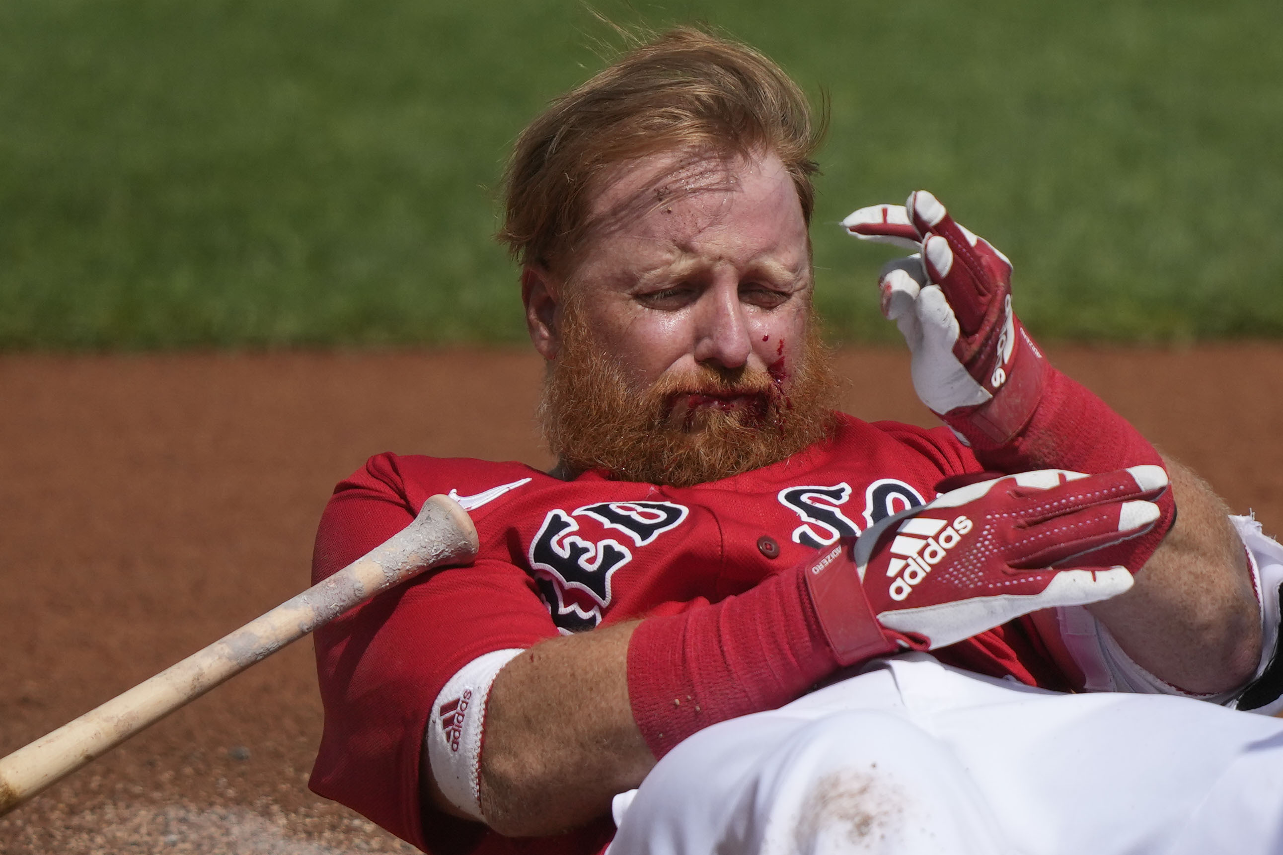 Boston Red Sox Justin Turner reacts after being hit in the face on a pitch by Detroit Tigers starting pitcher Matt Manning in the first inning of their spring training baseball game in Fort Myers, Fla., Monday, March 6, 2023. 