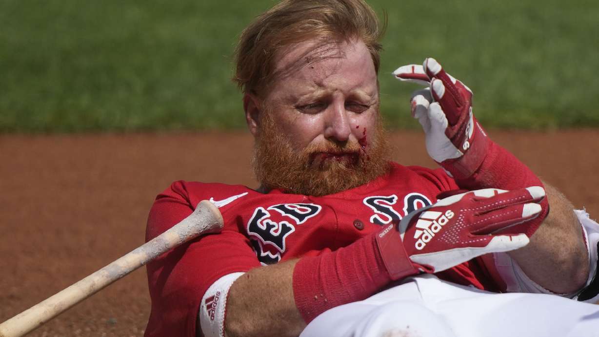 Boston Red Sox Justin Turner reacts after being hit in the face on a pitch by Detroit Tigers starting pitcher Matt Manning in the first inning of their spring training baseball game in Fort Myers, Fla., Monday, March 6, 2023.