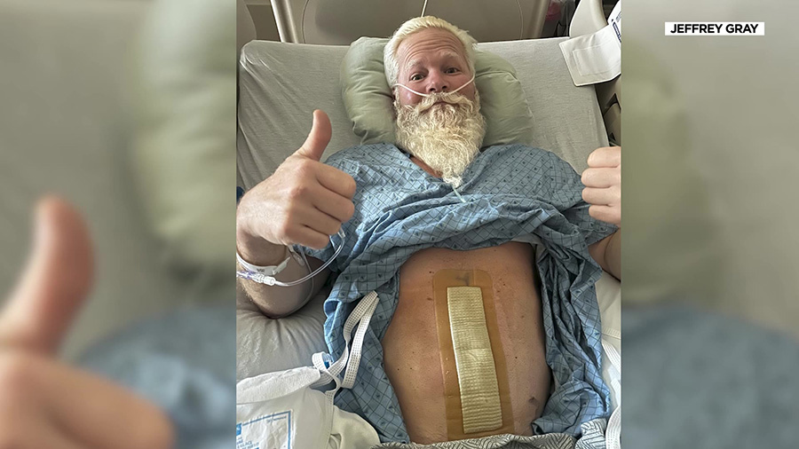 45 is the new 50 when it comes to colon cancer screenings