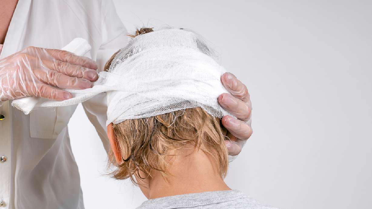 Utah woman scalped at work is forced to seek legal help