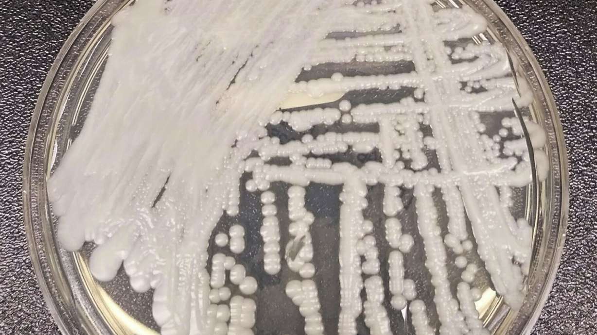 This undated photo made available by the Centers for Disease Control and Prevention shows a strain of Candida auris cultured in a petri dish at a CDC laboratory. U.S. cases of the dangerous fungus tripled over just three years.