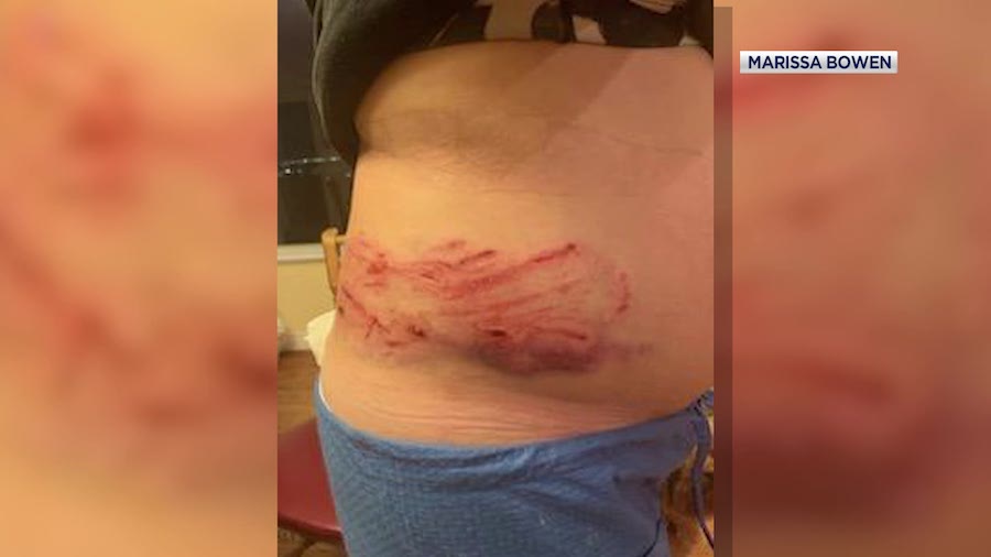 Marissa Bowen says she was injured on Mar. 14, when she was attacked by two Rottweilers she had stopped to help in Kearns.