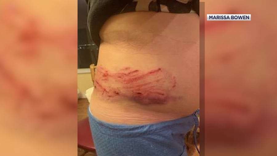 Marissa Bowen says she was injured on Mar. 14, when she was attacked by two Rottweilers she had stopped to help in Kearns.