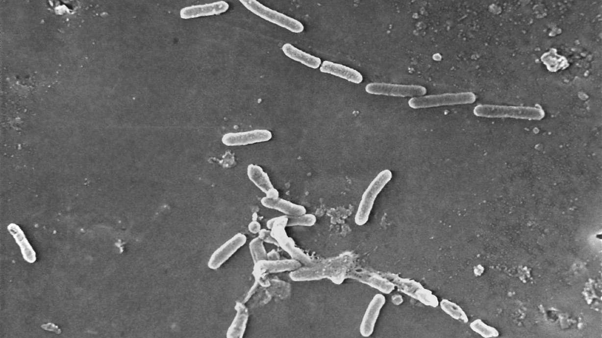 This scanning electron microscope image made available by the CDC shows rod-shaped bacteria. U.S. officials are reporting two more deaths and additional cases of vision loss linked to eyedrops tainted with the drug-resistant bacteria.