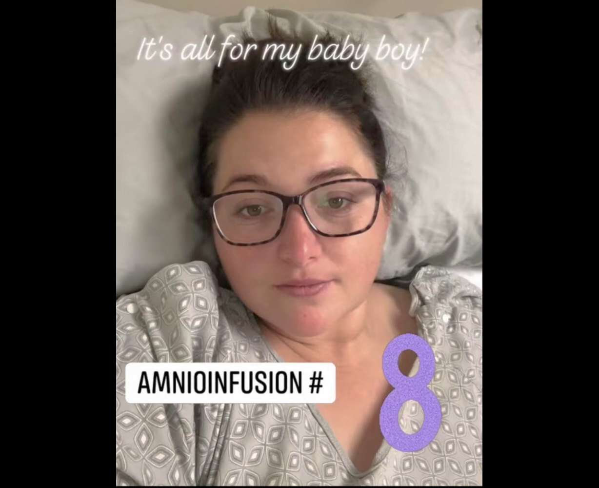 Kristen Shakespear at one of her amnio fusion procedures in Los Angeles. March is Kidney Awareness Month, and Shakespear and her family are using it as an opportunity to help find their son, Issac, who is living with no kidneys, a much-needed kidney.