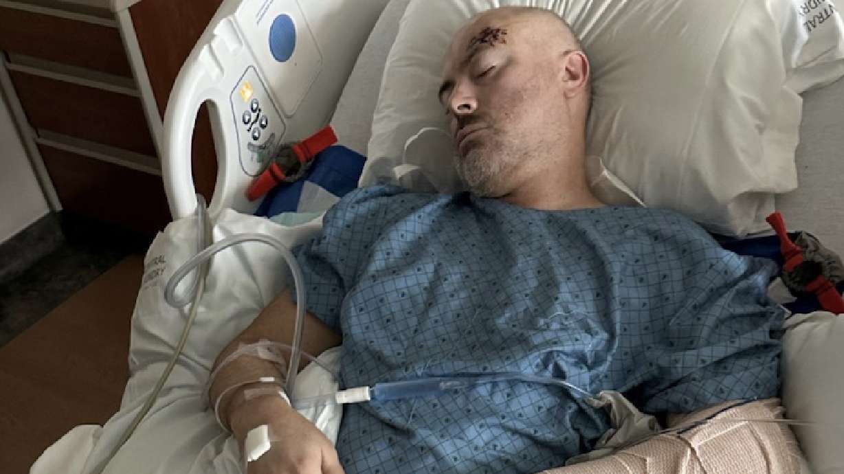 A motorcyclist tells of surviving a 150-foot fall;  He credits the Apple Watch for helping save his life