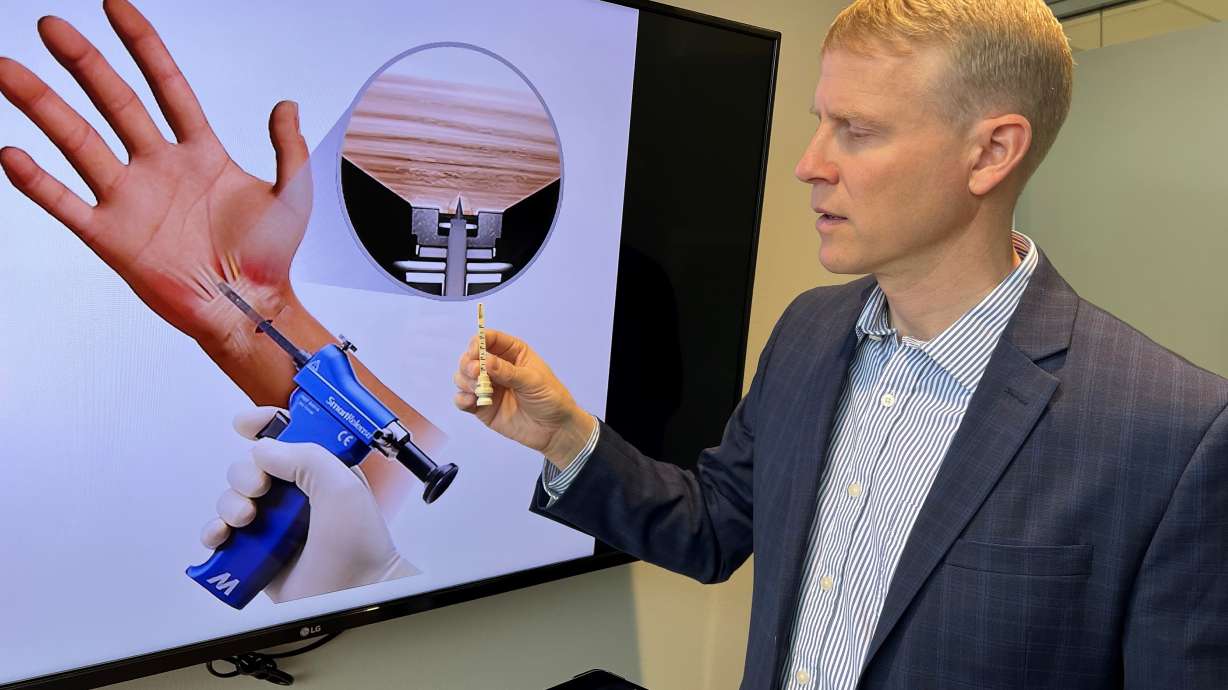 Utah's unique carpal tunnel clinic is celebrating 1 year