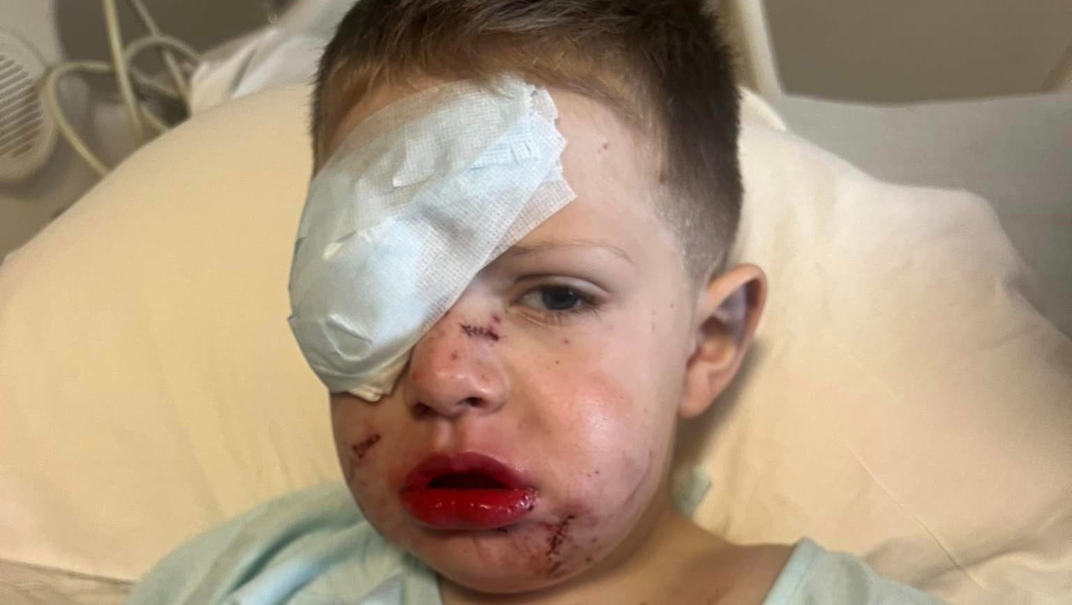 Sawyer Vrabec, 5, of Driggs was at Eastern Idaho Regional Medical Center in early April to recover from a dog mauling.