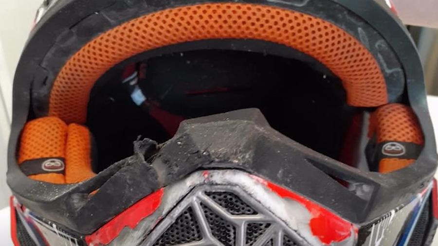 Crash survivor explains why it's important to wear a helmet when riding a motorcycle