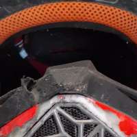 Crash survivor explains why it's important to wear a helmet when riding a motorcycle