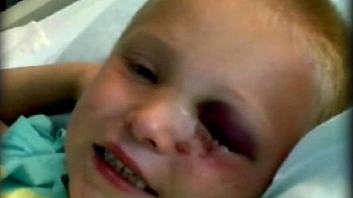 Utah Boy Recovers From Unusual Accident