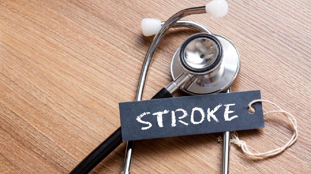 6 crucial letters to help you recognize when someone is having a stroke