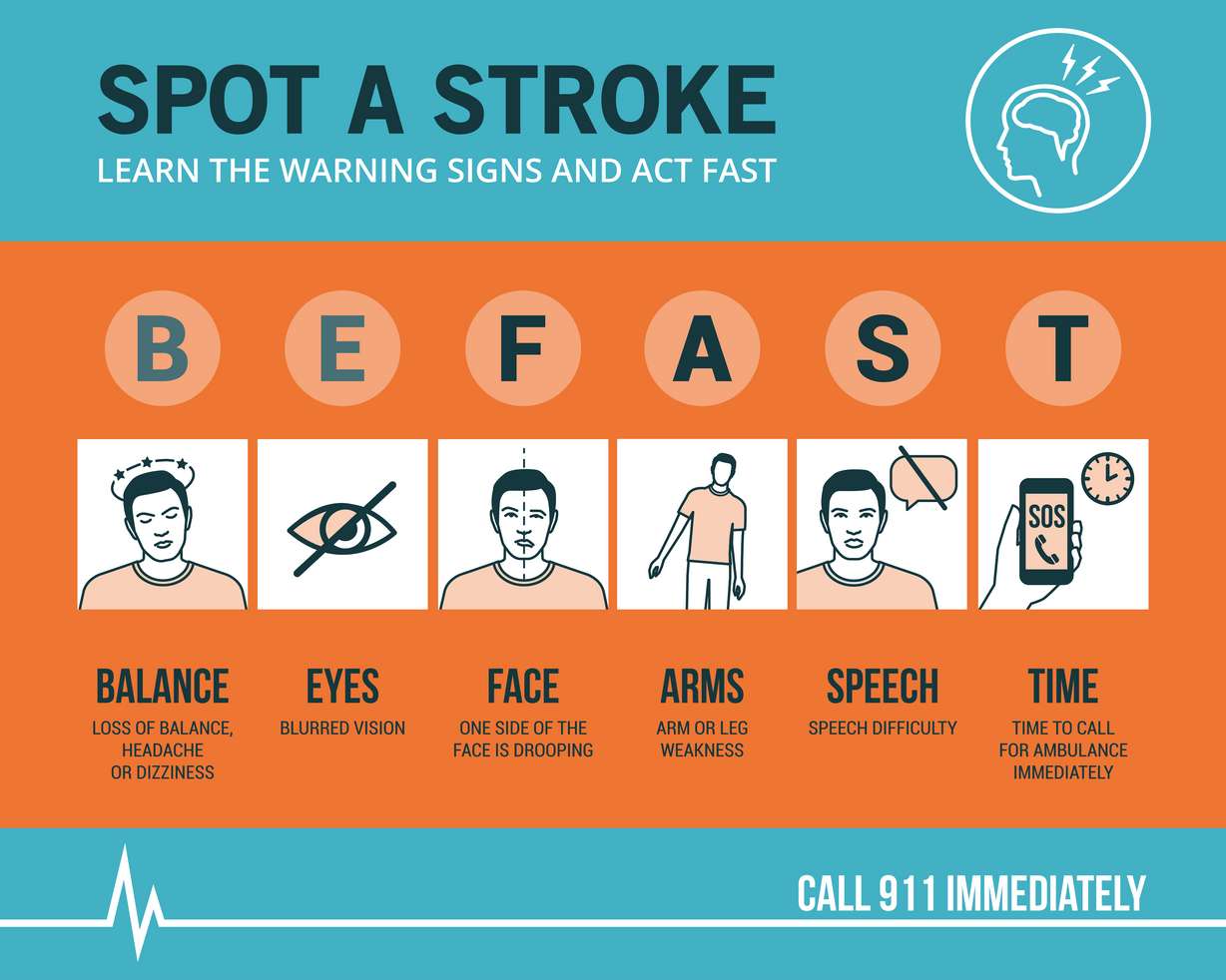 6 crucial letters to help you recognize when someone is having a stroke