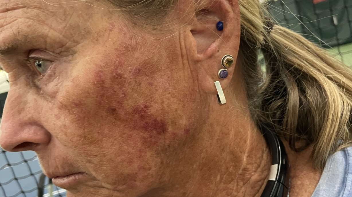 Former Park City High School girls tennis coach Lani Wilcox was legally justified in defending herself during a physical confrontation with a student at practice in August, a judge ruled Friday.