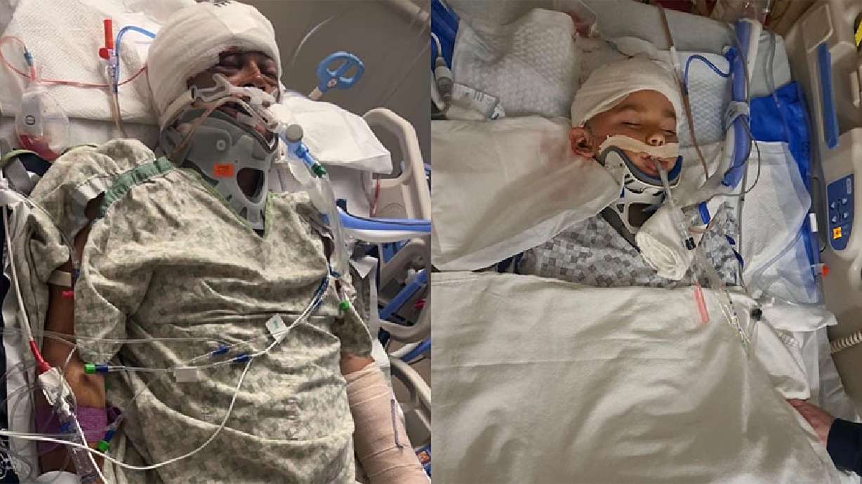 Roger Valentin and his son Rayce Valentin (left to right) were in a car accident in April. The Blackfoot family has fought a tough battle the past three years from cancer diagnoses to the severe car accident.