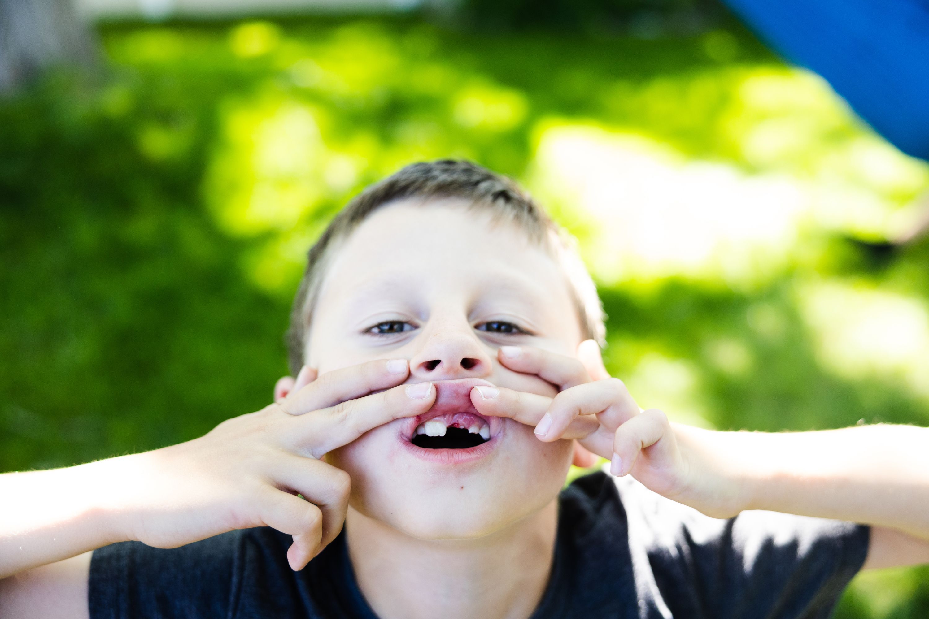 Eddie Perl, 7, shows off the gap in his teeth after losing a tooth while playing in the backyard of his home in Orem on Wednesday.