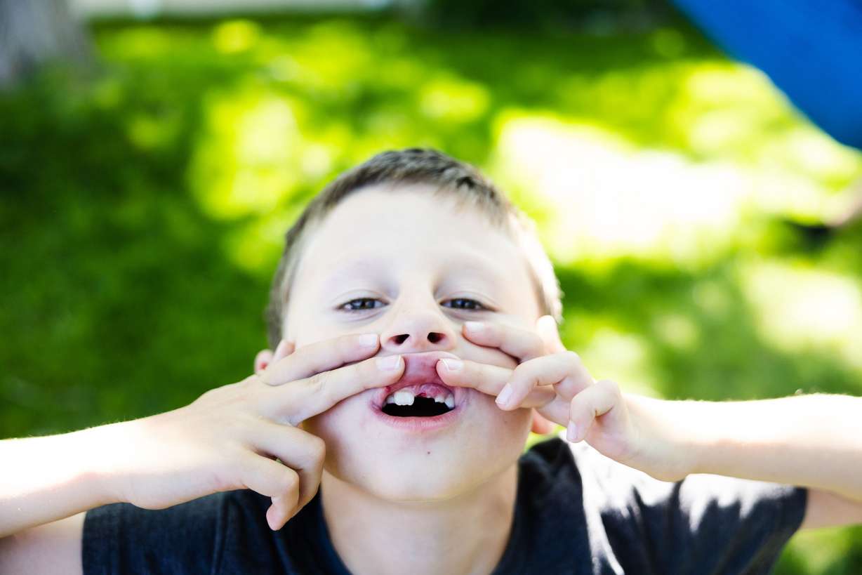 Eddie Perl, 7, shows off the gap in his teeth after losing a tooth while playing in the backyard of his home in Orem on Wednesday.
