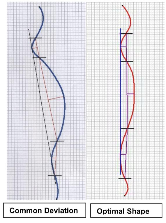 In the most common type of
spine shape deviation the rib cage curve becomes dominant,
which robs curve length from the neck and lower back. The lower back becomes short and flatter while the neck curve becomes shorter
and deeper.
