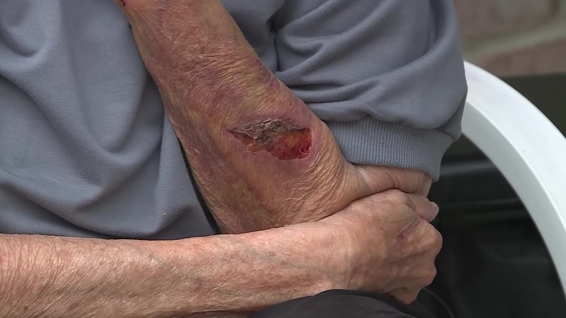 A 79-year-old woman was left bloodied and bruised after she was assaulted by two attackers who police are trying to find.