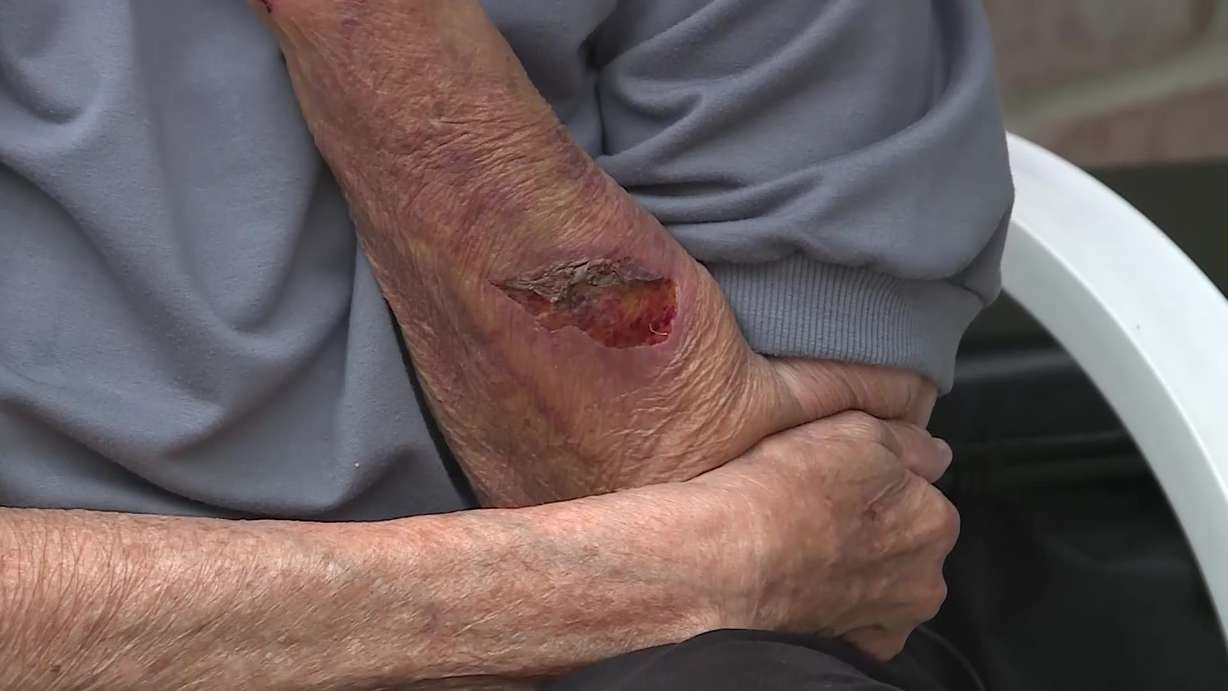 A 79-year-old woman was left bloodied and bruised after she was assaulted by two attackers who police are trying to find.