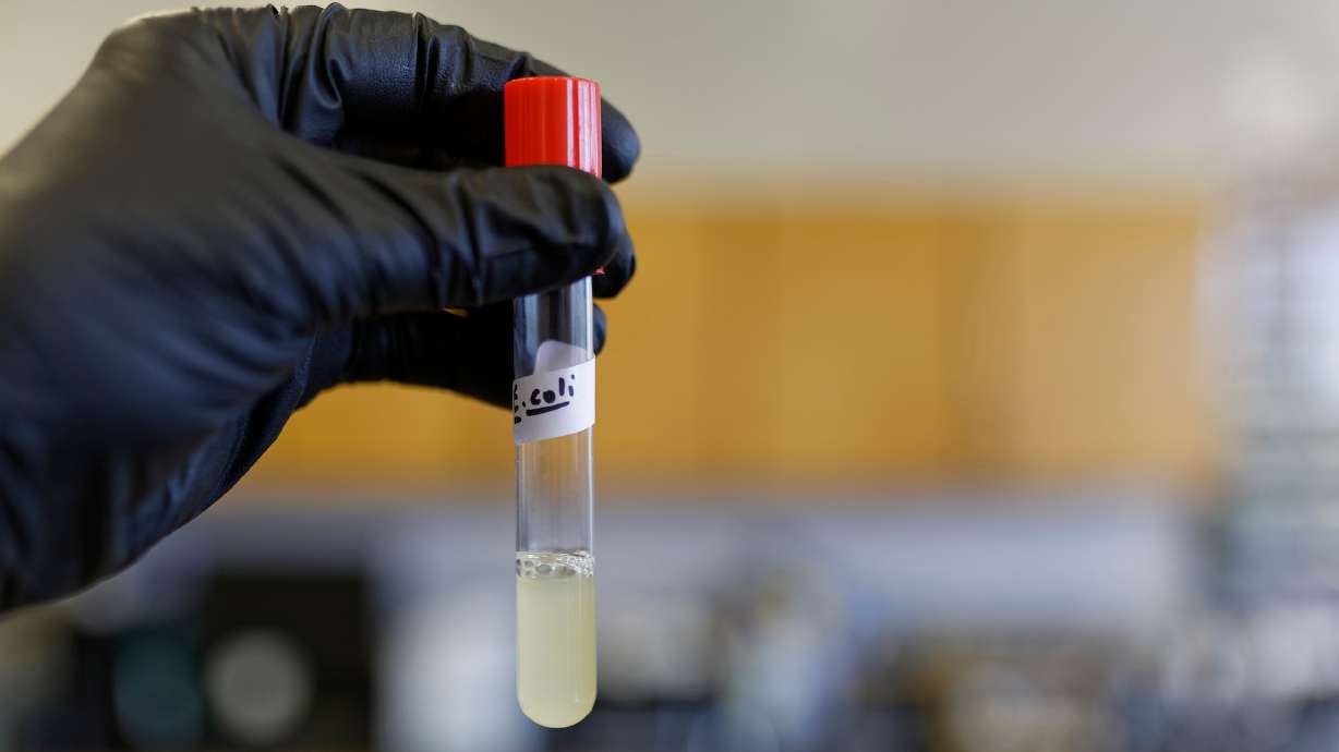 Utah County officials say there have been eight recent cases of E. coli infection reported in the county, all of which have been linked to Lehi residents.