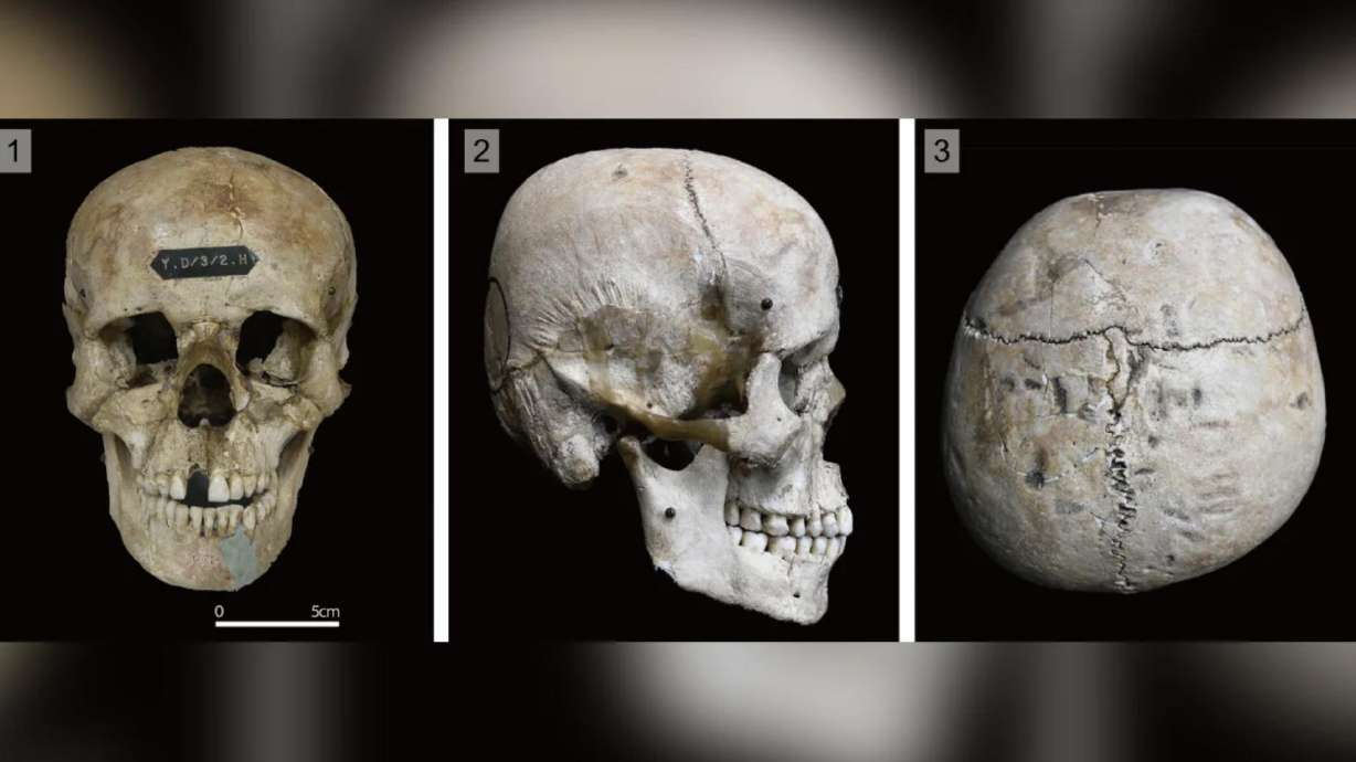 The modified skull of individual "HT4" from the Hirota site, on the island of Tanegashima in Japan, is shown (from left) in frontal, right-lateral and superior views.