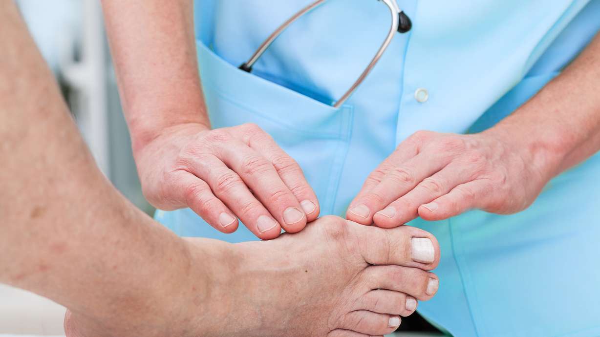 Pain-free feet possible with minimally invasive bunion surgery